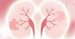 Kidney failure