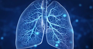 COPD