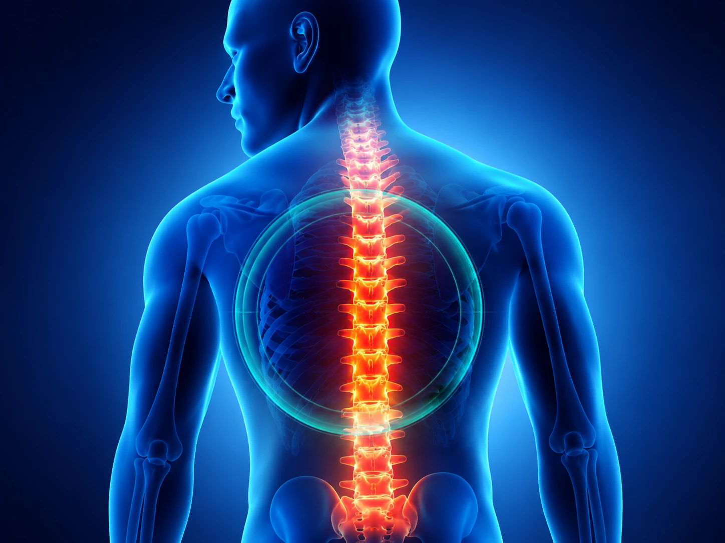 Spine Surgery